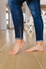 Zip-a-Dee-Doo-Dah Skinny Jeans